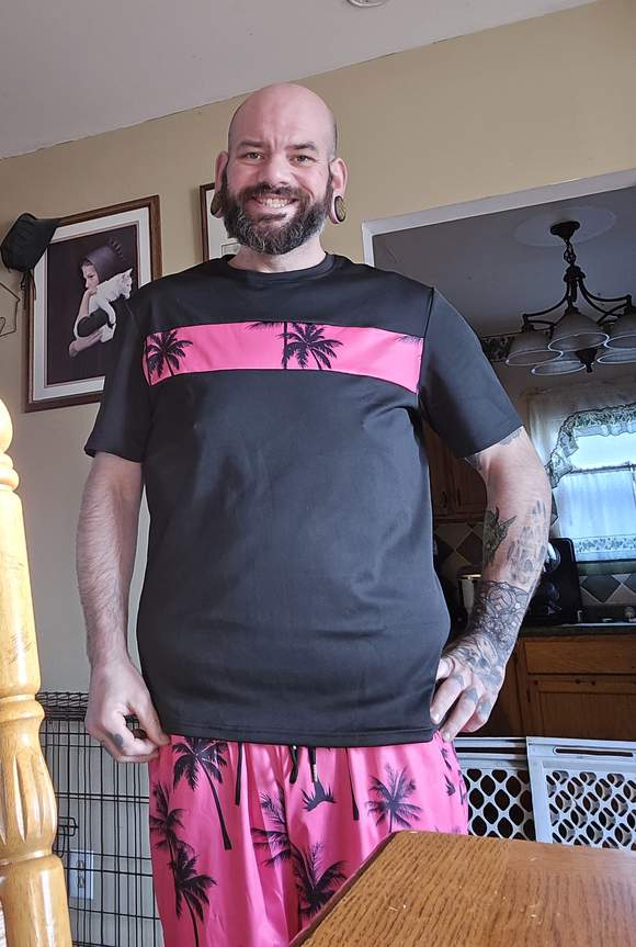 Robert Winker (post-surgery)